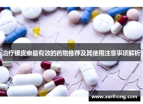 治疗银皮癣最有效的药物推荐及其使用注意事项解析